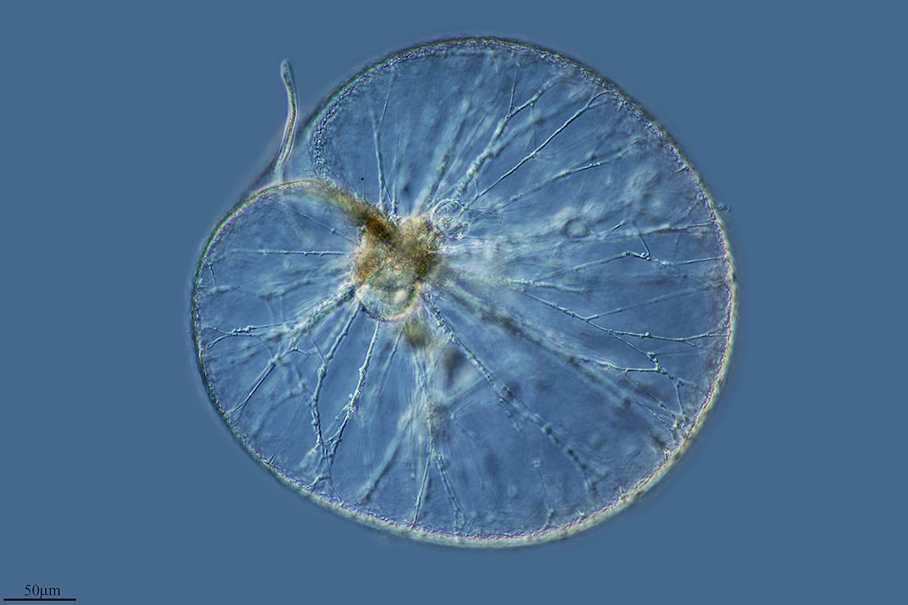 A microscopic image of a single, round phytoplankton with a tail-like appendage against a blue background.