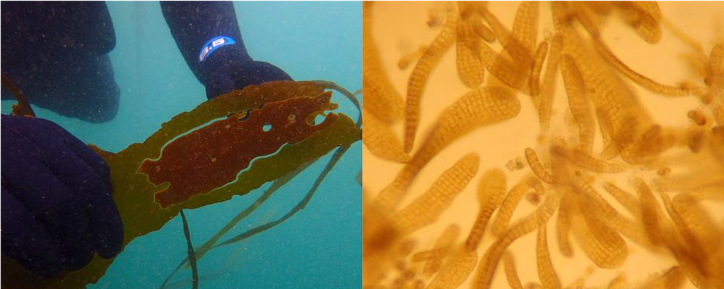A sorus patch in a blade of kelp (left) and spores at 100x magnification (right). Photo: Brian Allen/PSRF