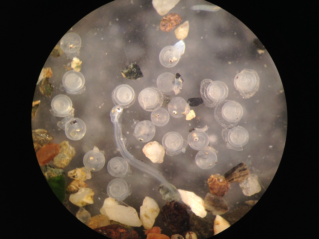 Surf smelt embryos under a microscope. Photo: Jamey Selleck 