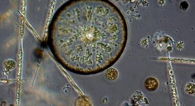 Microscopic view of diatoms in various shapes and sizes.