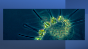 View of bright green, segmented, phytoplankton with spines under microscopic magnification.